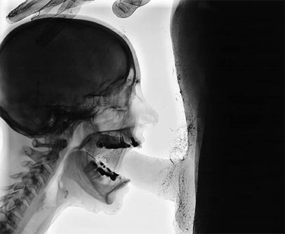 Radiografía 3